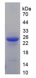 Mouse GC / Vitamin D-Binding Protein (Recombinant His)