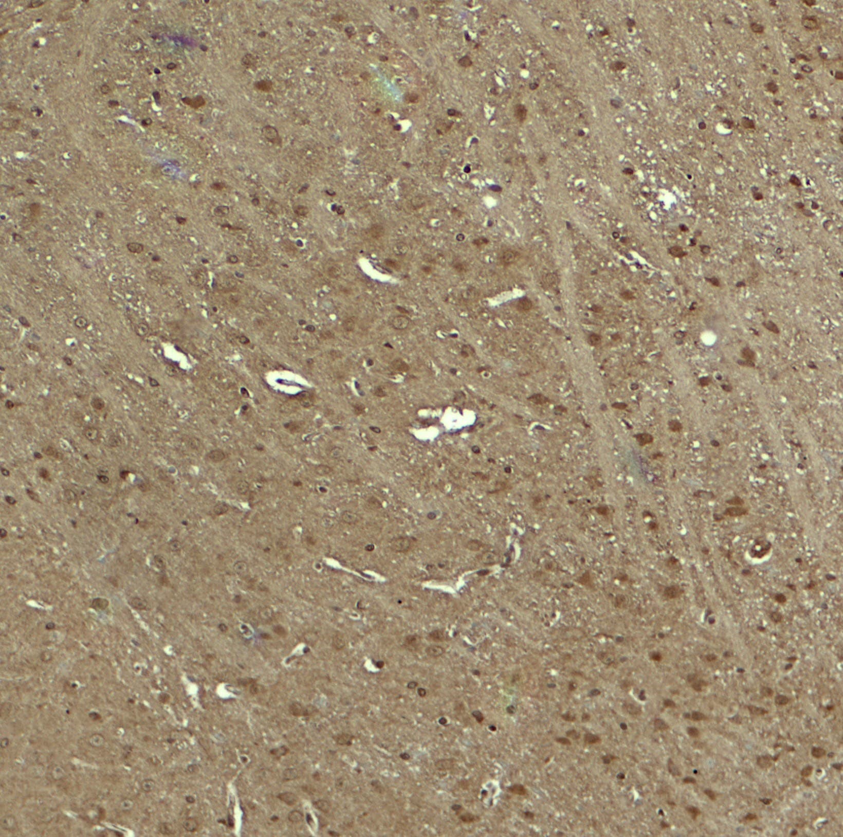 IHC-plus™ Polyclonal Rabbit anti-Human WWC1 / KIBRA Antibody (IHC, IF, WB)