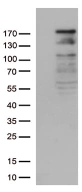 NEDD4 Antibody (aa160-460, clone OTI6B2, Carrier-free)