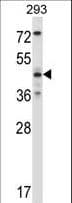 MAPK9 / JNK2 Antibody (aa206-233)
