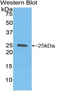 SPRY1 / Sprouty 1 Antibody (aa112-303, Cy3)