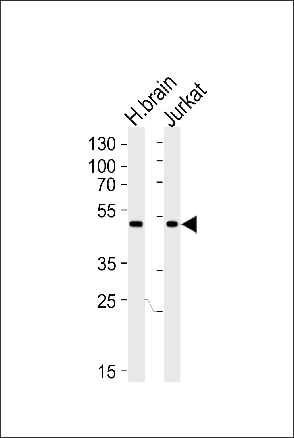 CHN1 Antibody (aa1-30)
