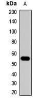 ACVR1C / ALK7 Antibody