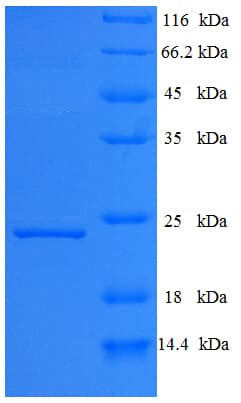 HEV / Hepatitis E Virus ORF1 Protein (Recombinant His)