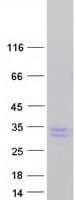 Human CLCF1 Protein (Recombinant Myc-DDK (Flag))