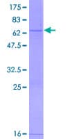 Human RDH12 / LCA3 Protein (Recombinant GST)