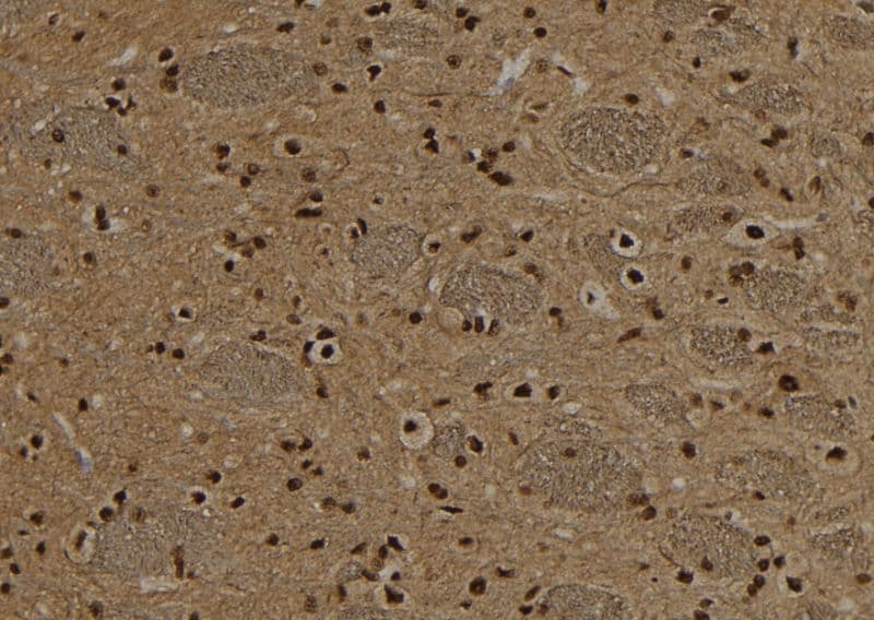 Polyclonal Rabbit anti-Human NSUN2 Antibody (IHC, IF, WB)