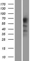 PACE4 / PCSK6 Protein (Over-Expression Lysate Myc-DDK (Flag))