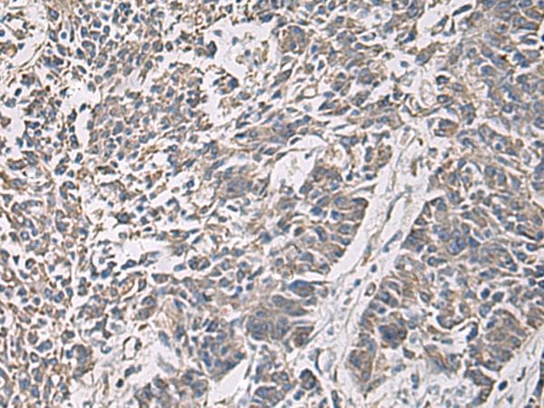 PRKCSH Antibody