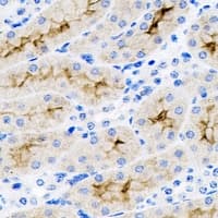 SET / TAF-I Antibody