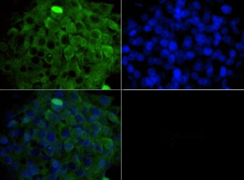 LAMTOR3 / MP1 Antibody