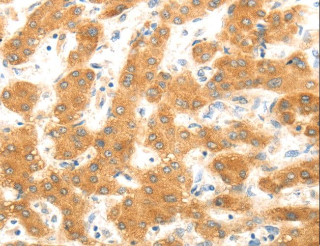 MAP2K6 / MEK6 / MKK6 Antibody