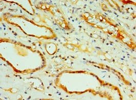 Polyclonal Rabbit anti-Human CREB3L2 / BBF2H7 Antibody (aa1-247, IHC, WB)