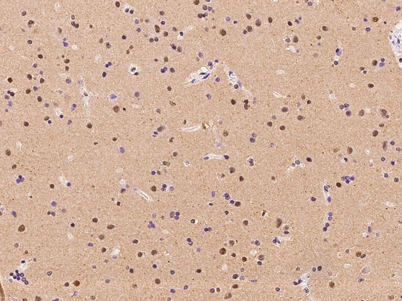 RBM17 Antibody