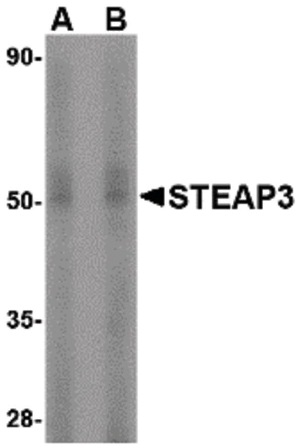 IHC-plus™ Polyclonal Rabbit anti-Human TSAP6 / STEAP3 Antibody (IHC, IF, WB)