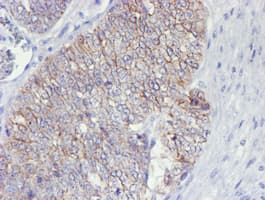 ERBB2 / HER2 Antibody (aa676-1255, clone OTI11A7, Carrier-free)