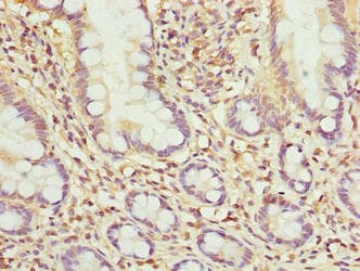 Polyclonal Rabbit anti-Human MRPL51 Antibody (IHC, WB)