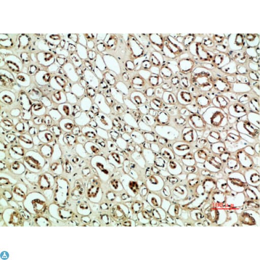 Polyclonal Rabbit anti-Human SNK / PLK2 Antibody (WB)