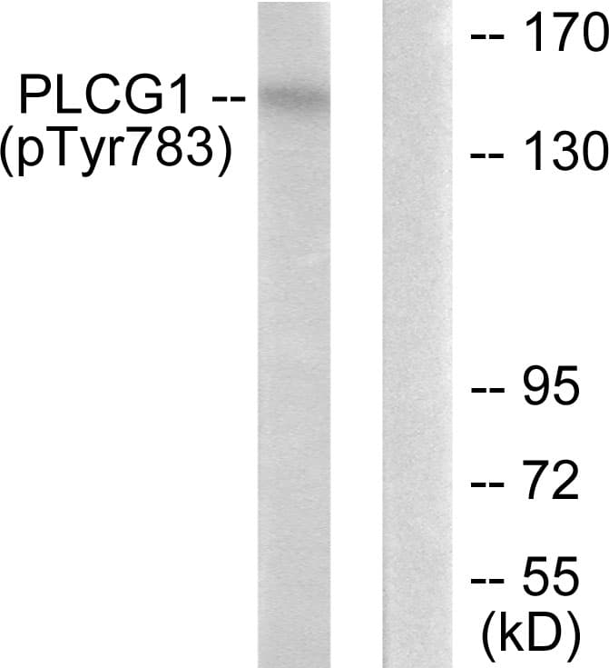 Polyclonal Rabbit anti-Human PLCG1 Antibody (phospho-Tyr783, IHC, WB)