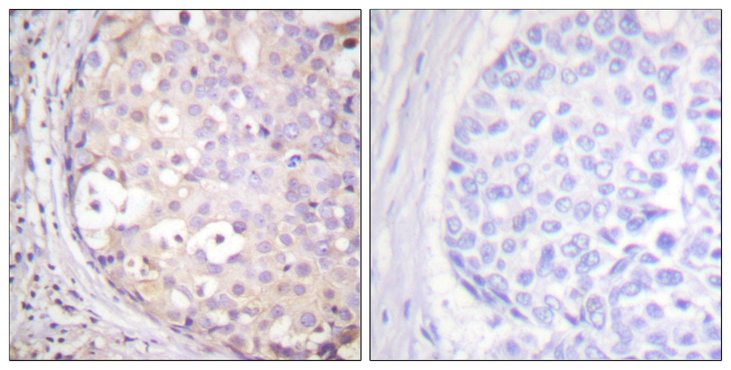 PKC / Protein Kinase C Antibody (phospho-Thr497)