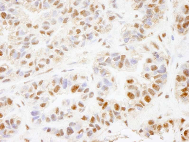 PHF8 Antibody (aa650-700)