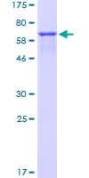Human MAGEA3 Protein (Recombinant GST)