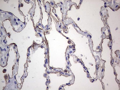 Acidic Cytokeratin Antibody (clone 8A3)