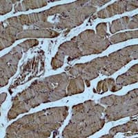 ACTA1 / Skeletal Muscle Actin Antibody