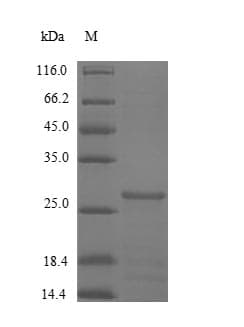 Human CSTB / Cystatin B / Stefin B Protein (Recombinant 6His-SUMO, N-terminus)