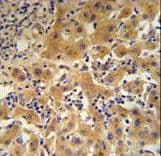 CP / Ceruloplasmin Antibody (aa121-151)