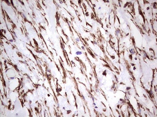 Peripherin Antibody (clone OTI1E10)
