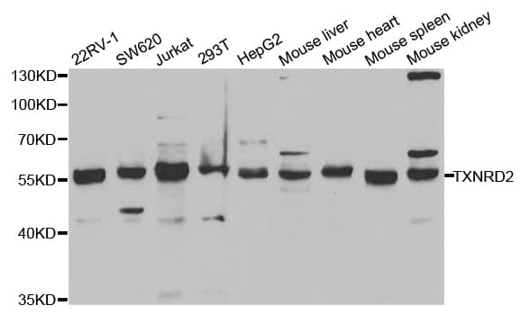 Polyclonal Rabbit anti-Human TXNRD2 Antibody (IHC, WB)