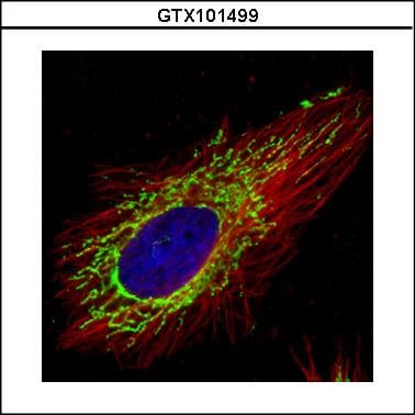 IHC-plus™ Polyclonal Rabbit anti-Human COXIV / COX4 Antibody (aa1-169, IHC, WB)