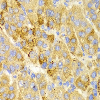 Polyclonal Rabbit anti-Human LAMP3 / CD208 Antibody (IHC, WB)