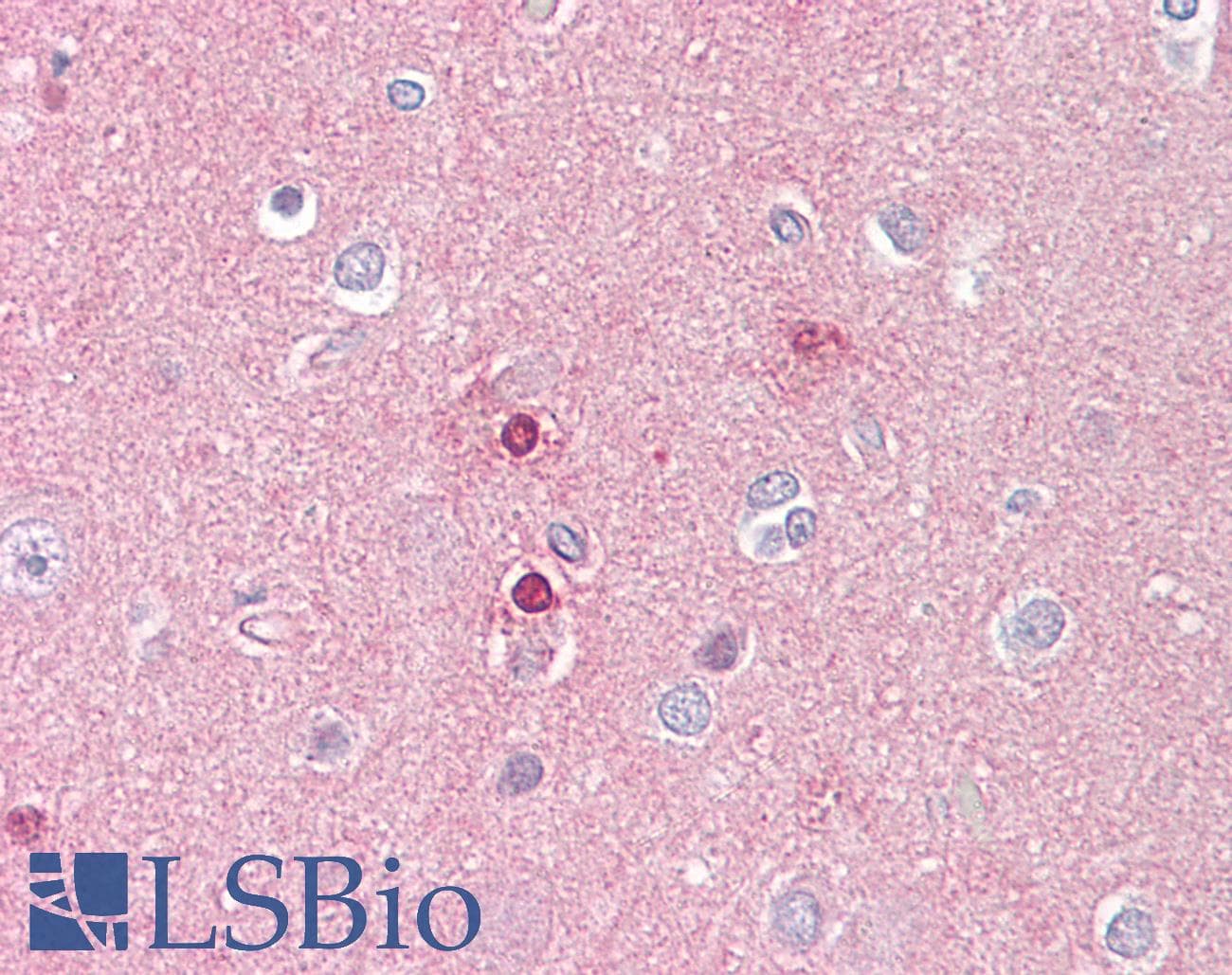 IHC-plus™ Polyclonal Rabbit anti-Human UBR5 Antibody (aa1-50, IHC, WB)