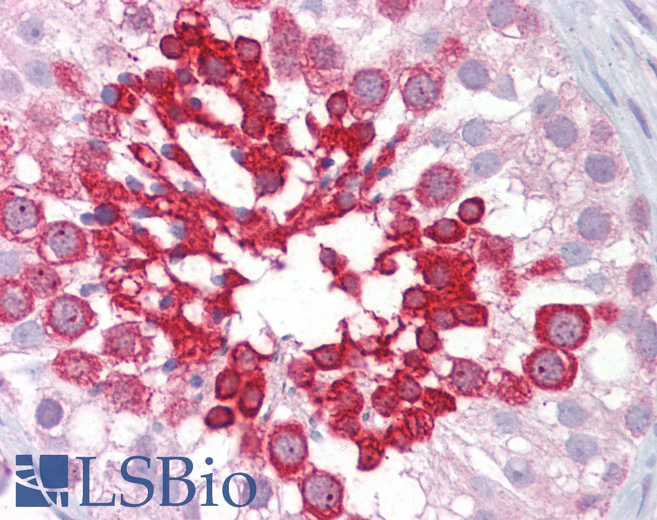 IHC-plus™ Polyclonal Rabbit anti-Human ROCK2 Antibody (IHC, IF, WB)