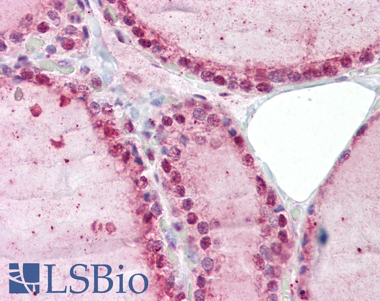IHC-plus™ Polyclonal Rabbit anti-Human ZNF346 Antibody (IHC, IF, WB)