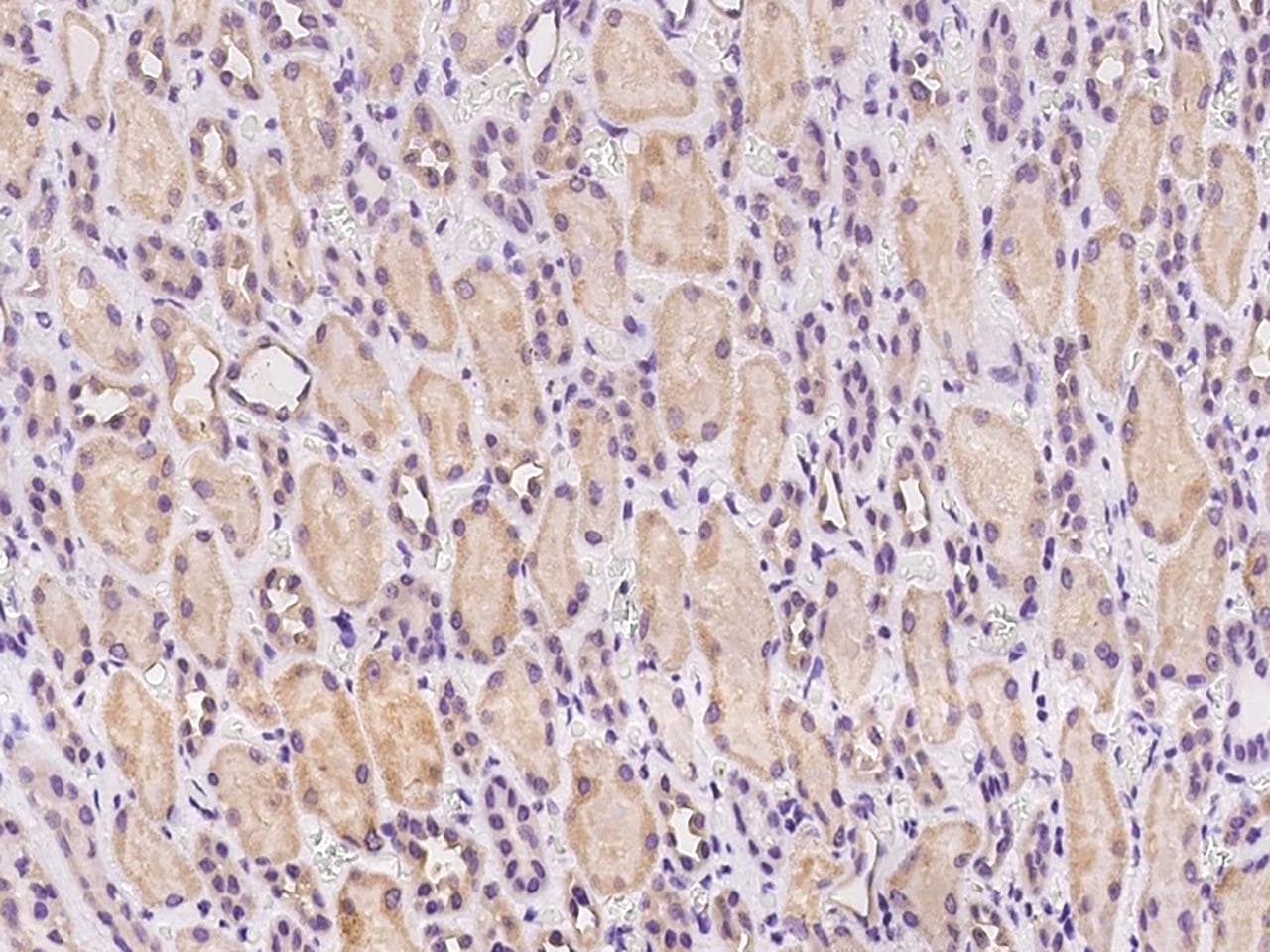 Polyclonal Rabbit anti-Human C1orf43 Antibody (IHC)