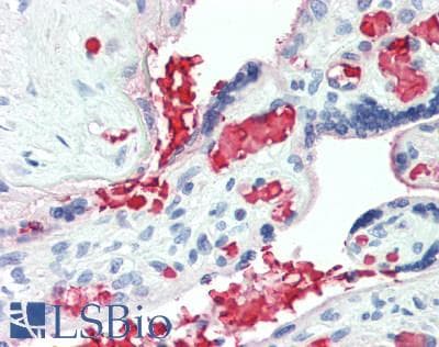 IHC-plus™ HBB / Hemoglobin Beta Antibody (aa1-147)