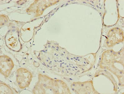 Polyclonal Rabbit anti-Human MAOA / Monoamine Oxidase Antibody (IHC, WB)