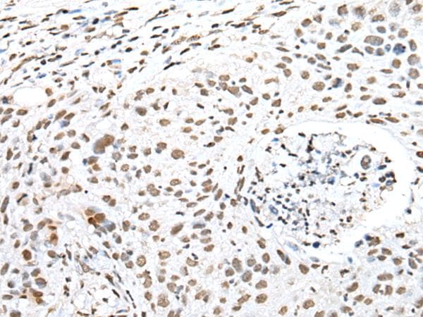 SNRPA / U1A Antibody