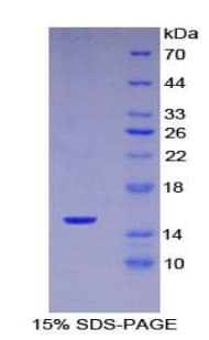 Mouse SERPING1 / C1 Inhibitor Protein (Recombinant His)