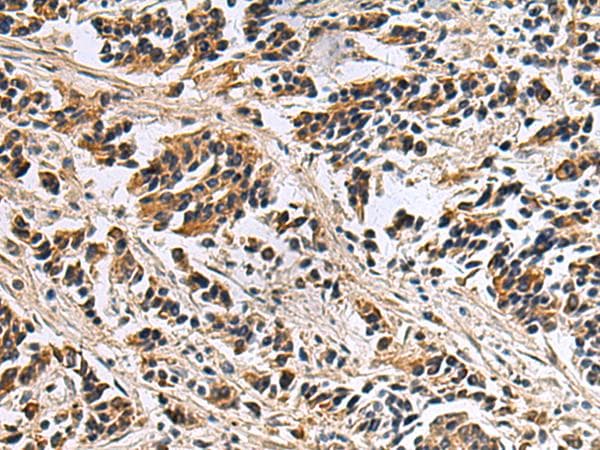 DIAPH2 Antibody