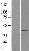 BBS5 Protein (Over-Expression Lysate Myc-DDK (Flag))