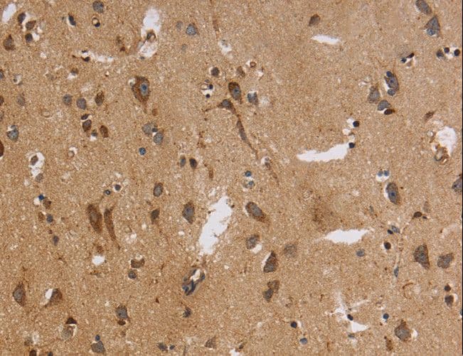 ITPR3 Antibody