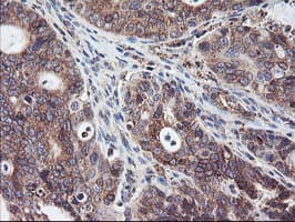 SH2D2A Antibody (clone OTI4F3)