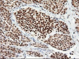 ERCC1 Antibody (clone 2.00E+12)