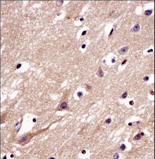 Polyclonal Rabbit anti-Human C4orf49 / OSAP Antibody (aa176-204, IHC, WB)