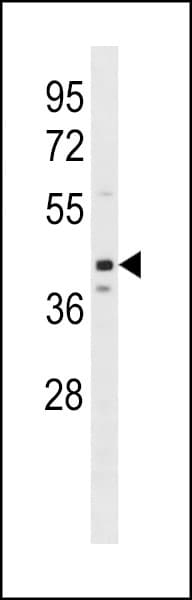 OPTIMEDIN / OLFM3 Antibody (aa114-142)