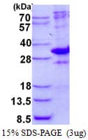 Human MED7 / CRSP9 Protein (Recombinant His)